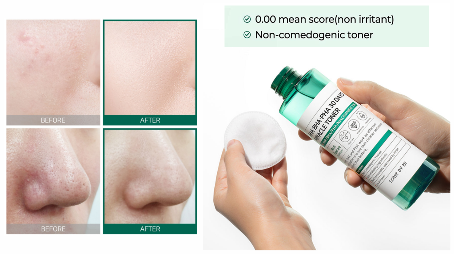 تونر-آبرسان-و-ضد-جوش-مدل-میراکل-سام-بای