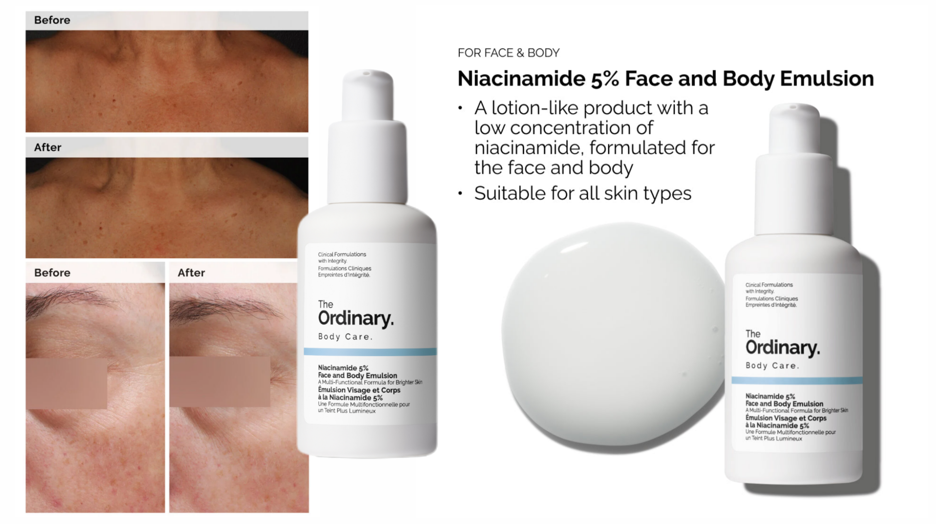 امولسیون-روشن-کننده-صورت-و-بدن-نیاسینا امولسیون-روشن-کننده-صورت-و-بدن-نیاسینا