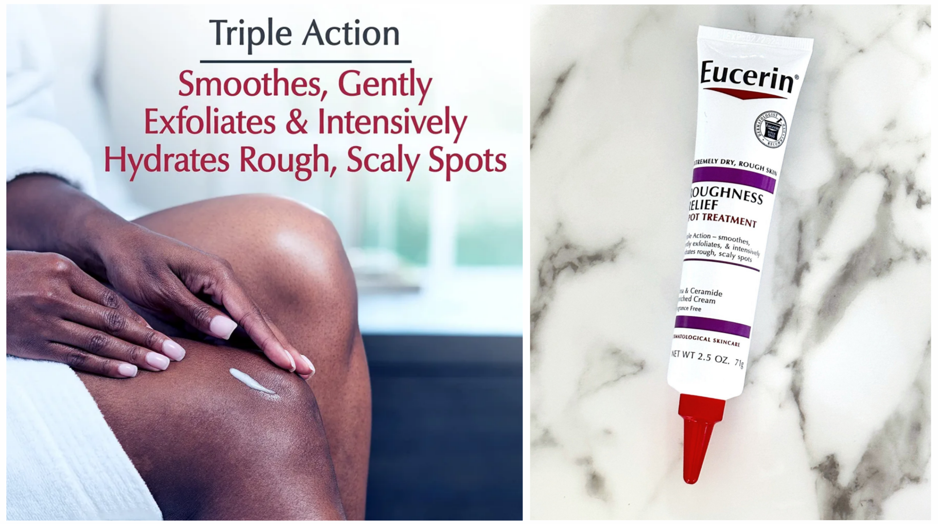 ژل-کرم-درمان-لک-و-مرطوب-کننده-بدن-اوسرین ژل-کرم-درمان-لک-و-مرطوب-کننده-بدن-اوسرین