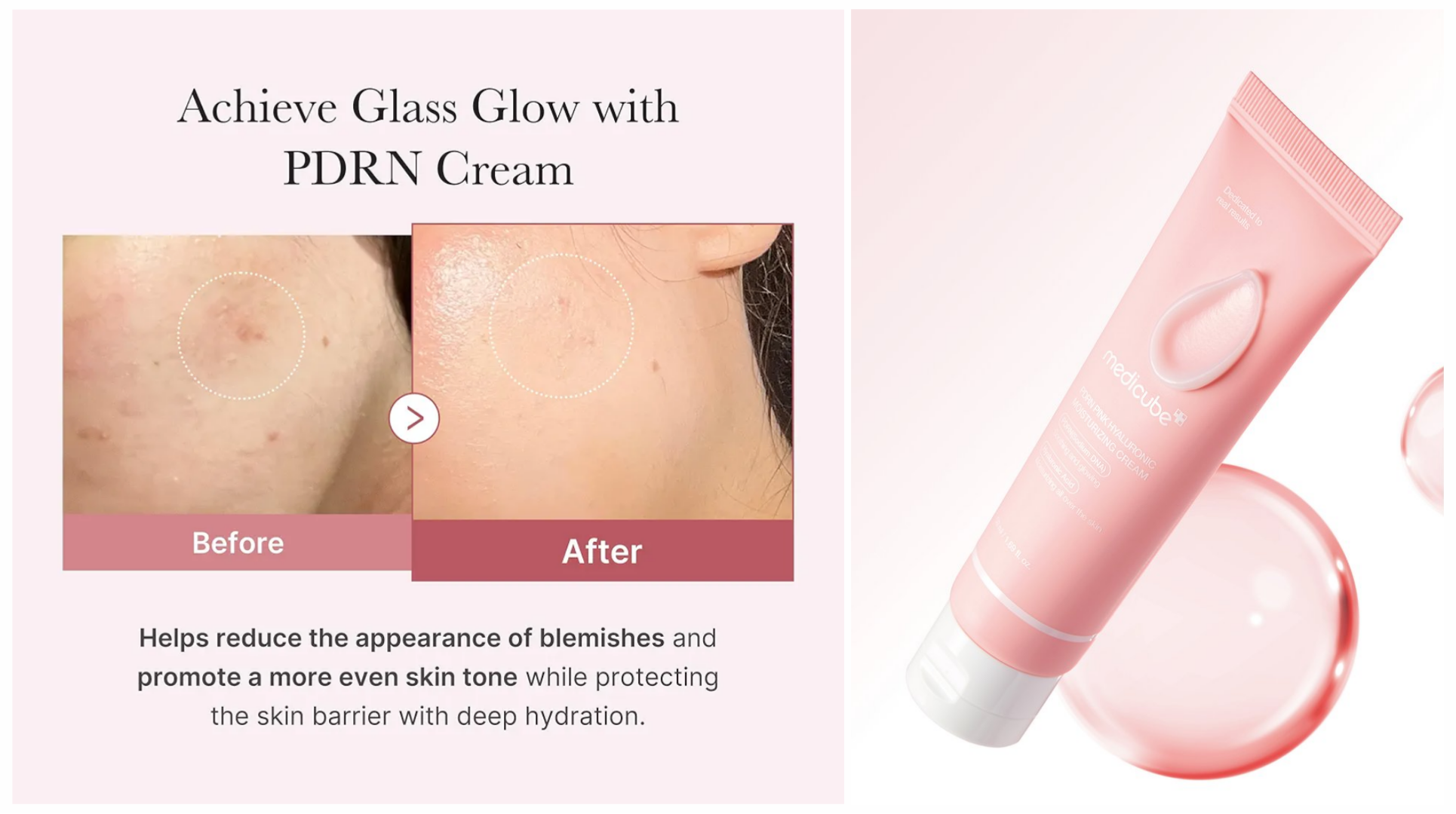 کرم-مرطوب-کننده-هیالورونیک-و-pdrn-صورتی-مد کرم-مرطوب-کننده-هیالورونیک-و-pdrn-صورتی-مد