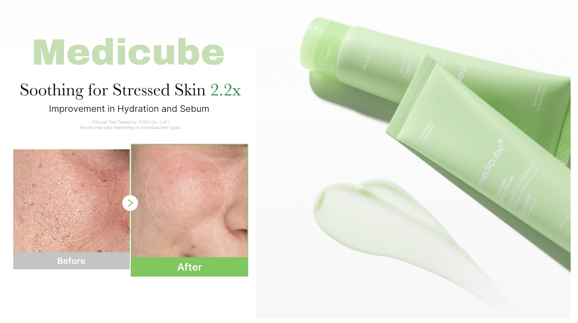 کرم-تسکین-دهنده-و-مرطوب-کننده-مدل-اگزوز کرم-تسکین-دهنده-و-مرطوب-کننده-مدل-اگزوز