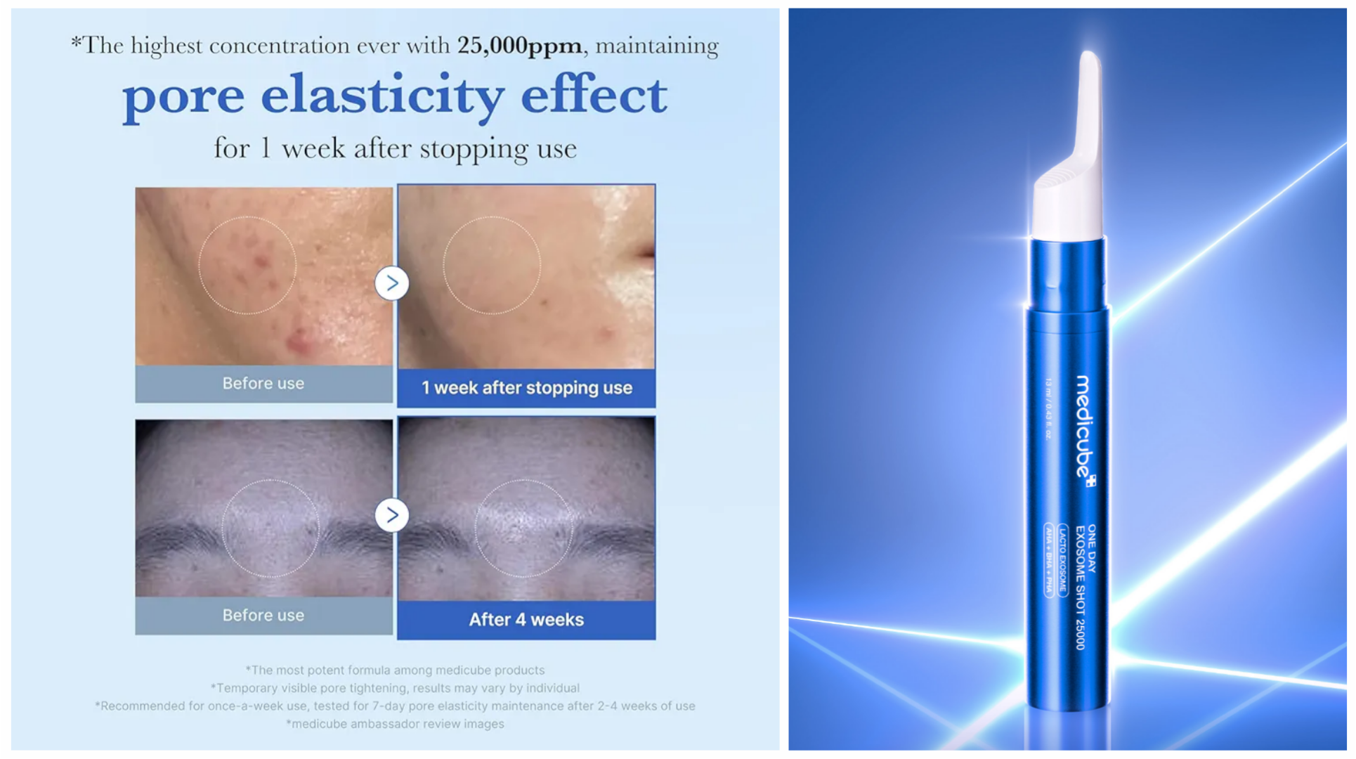 آمپول-کنترل-منافذ-وان-دی-اگزوزوم-شات-2500 آمپول-کنترل-منافذ-وان-دی-اگزوزوم-شات-2500