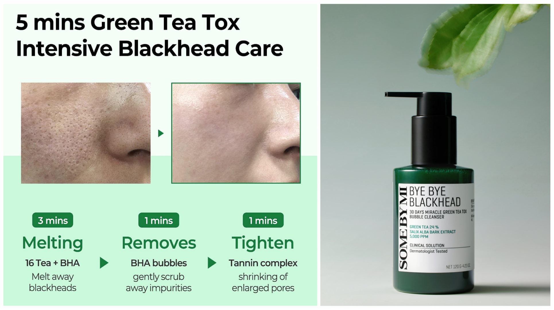 پاک-کننده-حبابی-جوش-های-سرسیاه-مدل-میرا