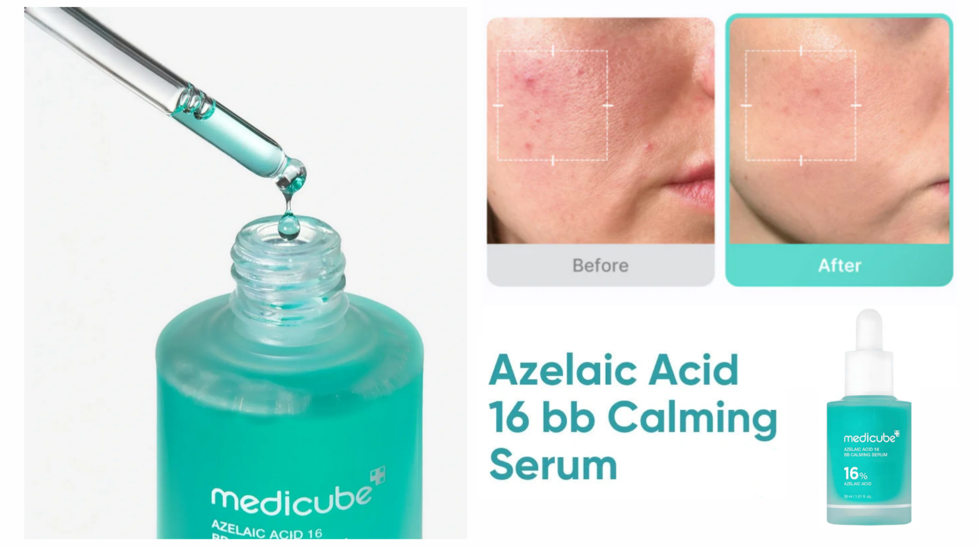 سرم-تسکین-دهنده-و-ضد-جوش-آزلائیک-اسید-مد سرم-تسکین-دهنده-و-ضد-جوش-آزلائیک-اسید-مد