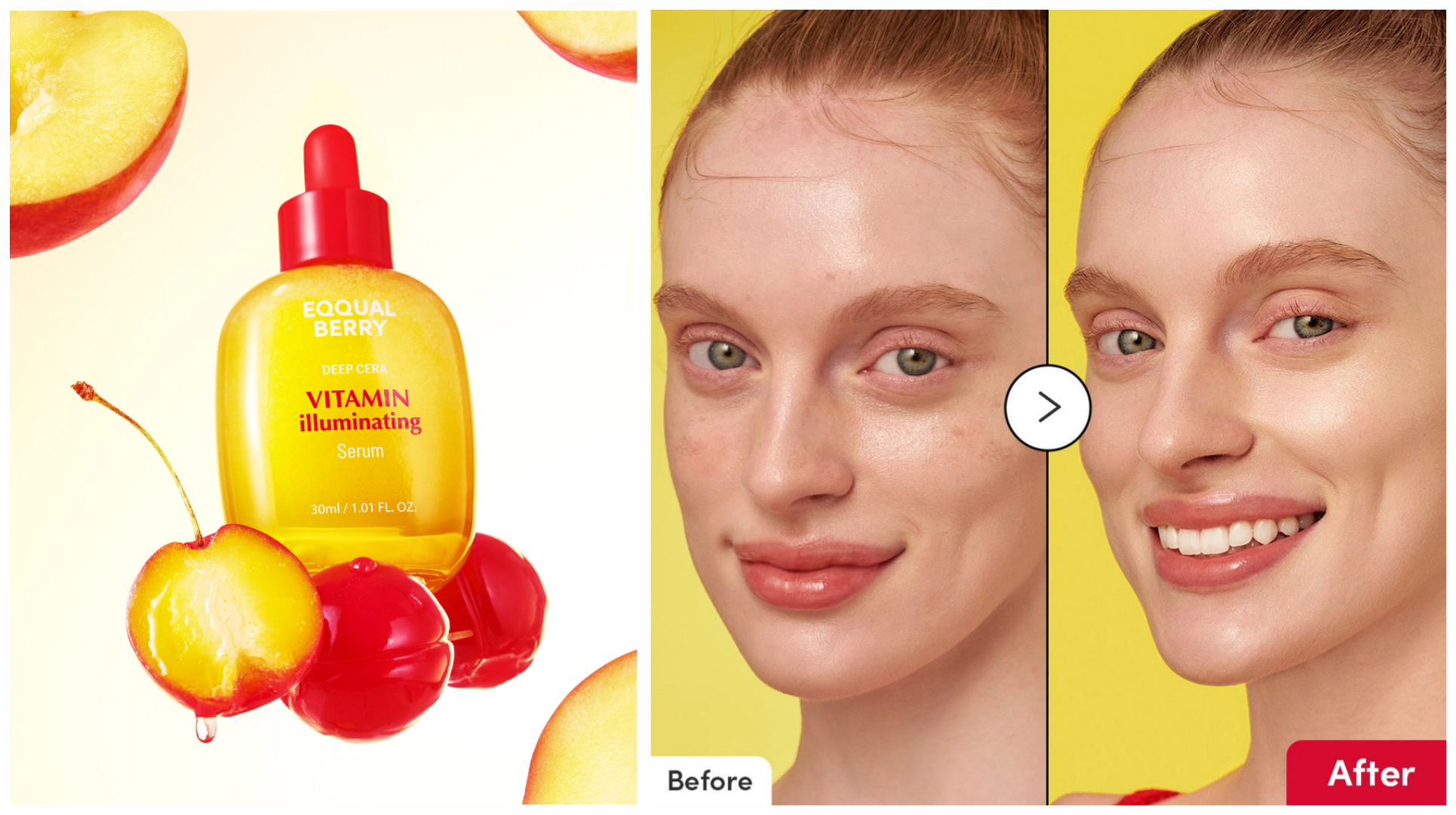 سرم-ضد-لک-و-روشن-کننده-ویتامین-ایلومینی سرم-ضد-لک-و-روشن-کننده-ویتامین-ایلومینی